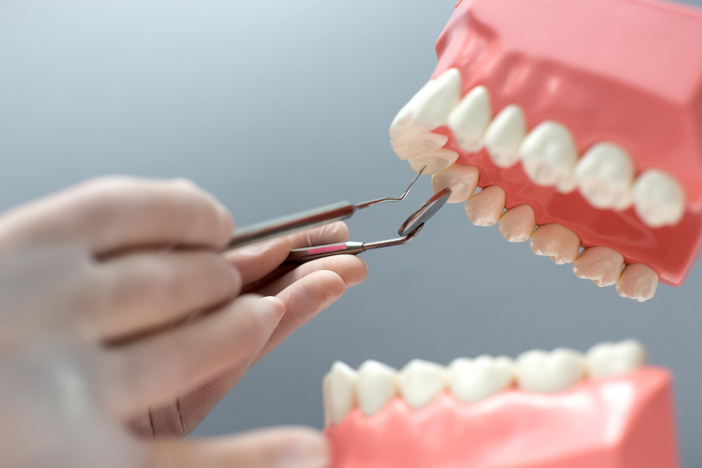 Reabilitação Oral em Diferentes Fases da Vida 4 dentes protese